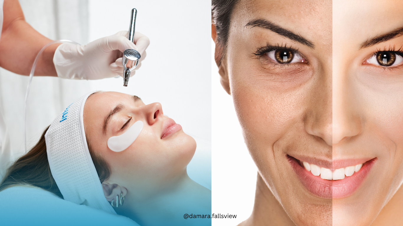 Microdermabrasion vs. OXYGENEO vs. Intraceuticals: Which Treatment Is Right for You?