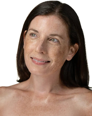 Dry Skin